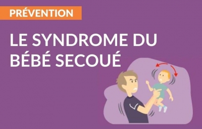 متلازمة هز الرضيع