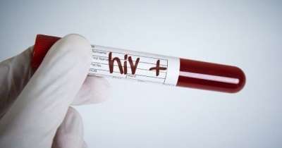 VIH SIDA le 07/01/2021 a 11H